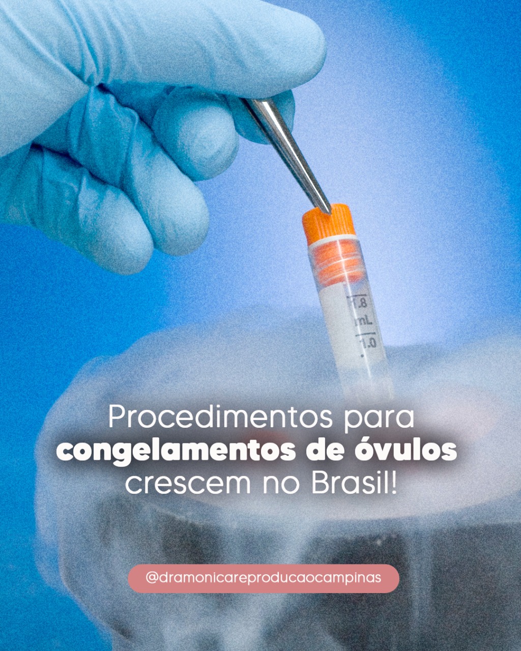 Procedimentos para Congelamento de Óvulos crescem no Brasil - Dra ...