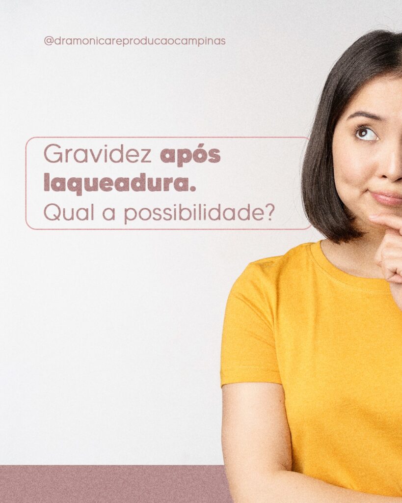 gravidez-apos-laqueadura-qual-possibilidade-dra-monica-reproducao-humana-campinas-sp