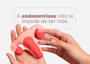 endometriose-nao-impede-de-ser-mae-dra-monica-jorge-ginecologista-especialista-reproducao-humana-infertilidade-diagnostico