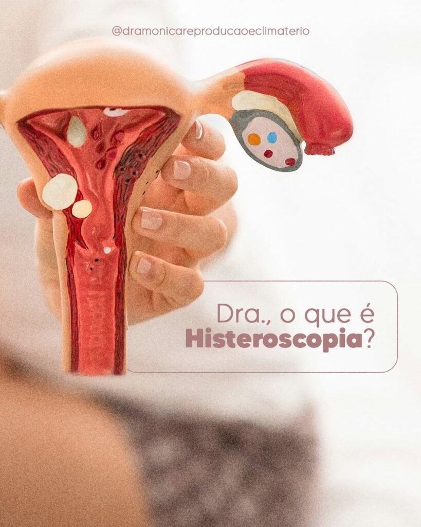 o-que-eh-histeroscopia-dra-monica-jorge-ginecologista-especialista-reproducao-humana-infertilidade-diagnostico-fiv-fertilizacao-in-vitro-campinas